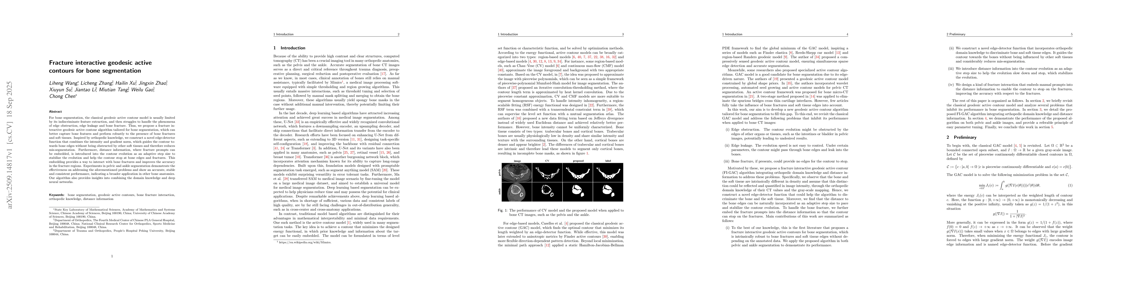 Thumbnail for Fracture interactive geodesic active contours for bone segmentation