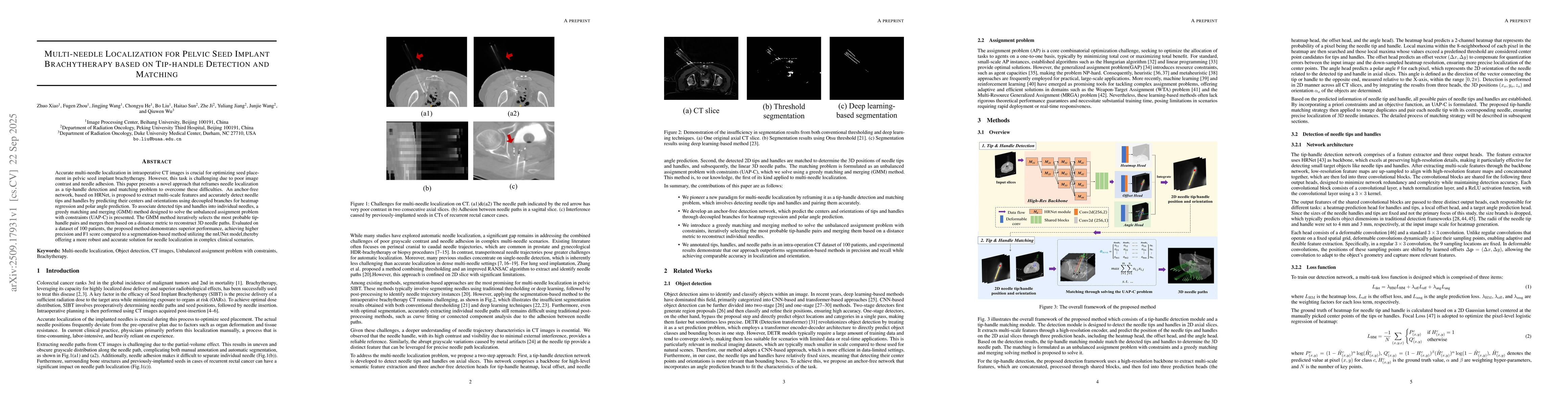 Thumbnail for Multi-needle Localization for Pelvic Seed Implant Brachytherapy based on
  Tip-handle Detection and Matching