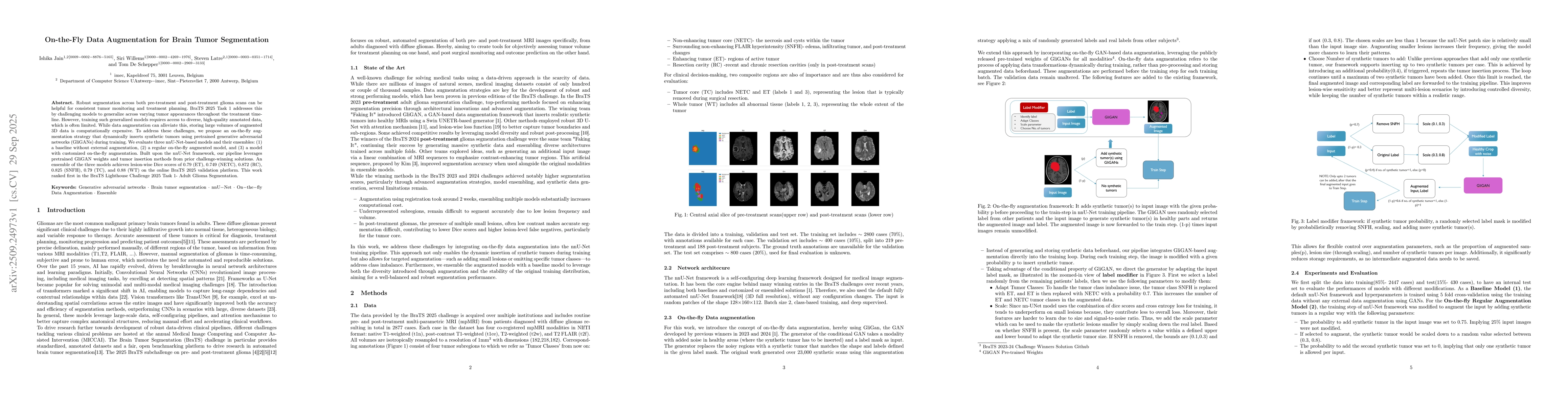 Thumbnail for On-the-Fly Data Augmentation for Brain Tumor Segmentation