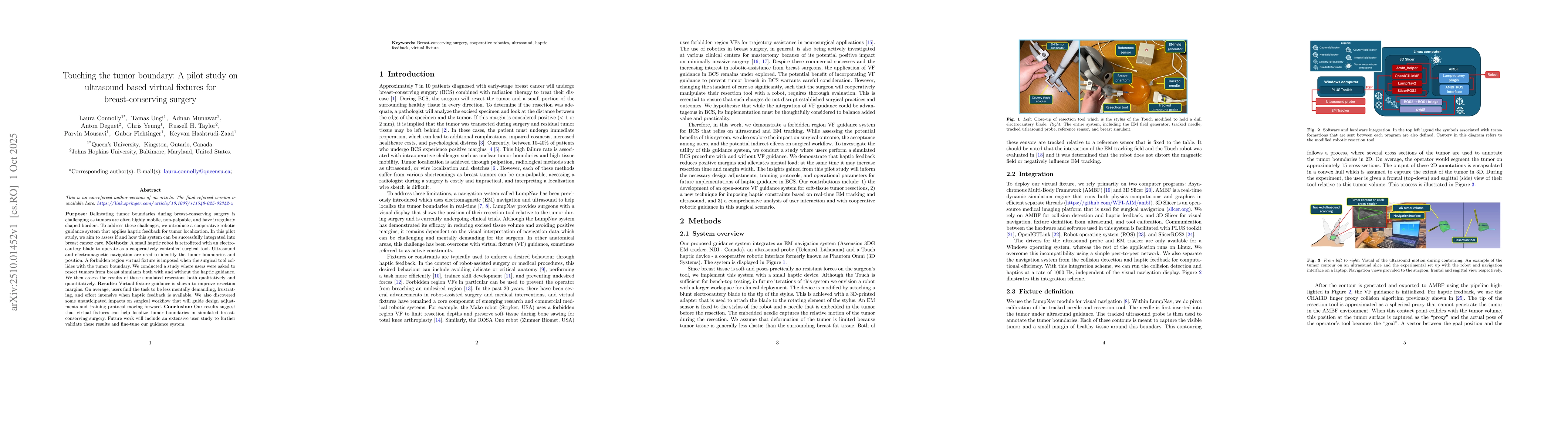 Thumbnail for Touching the tumor boundary: A pilot study on ultrasound based virtual
  fixtures for breast-conserving surgery