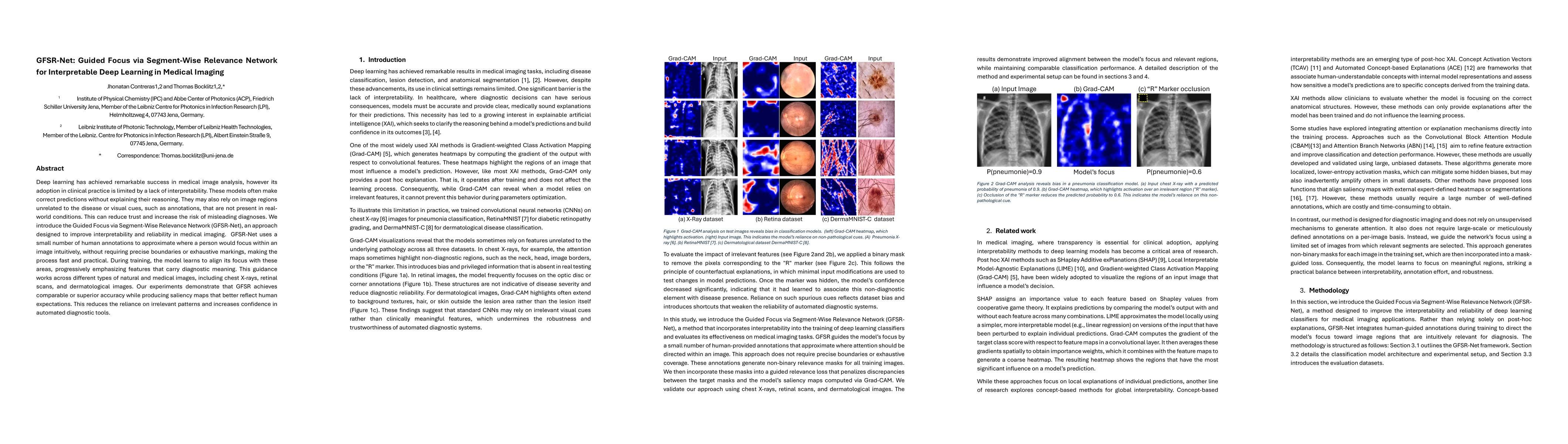 Thumbnail for GFSR-Net: Guided Focus via Segment-Wise Relevance Network for
  Interpretable Deep Learning in Medical Imaging