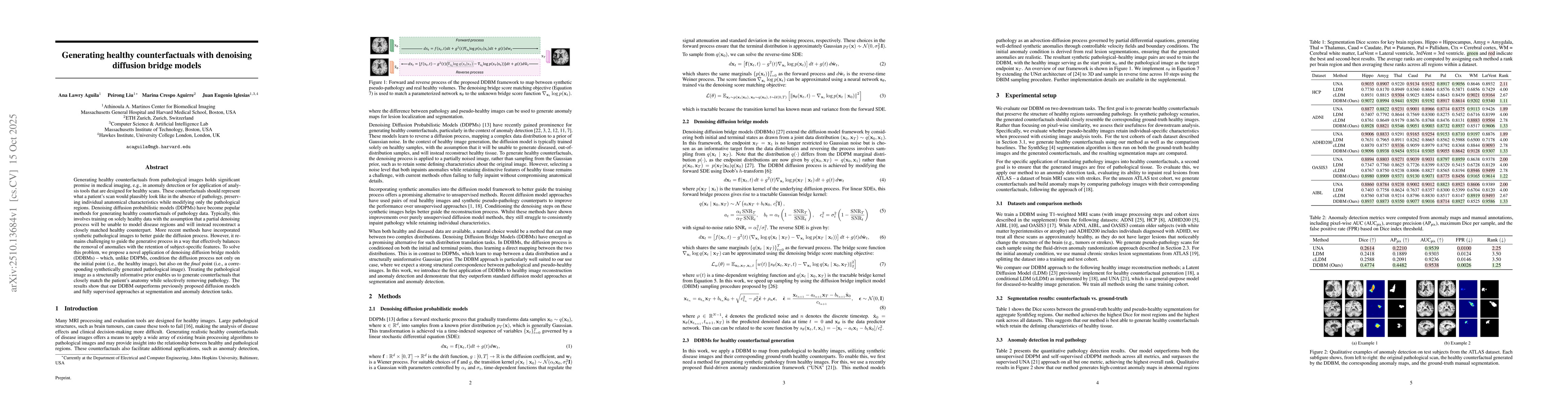 Thumbnail for Generating healthy counterfactuals with denoising diffusion bridge
  models