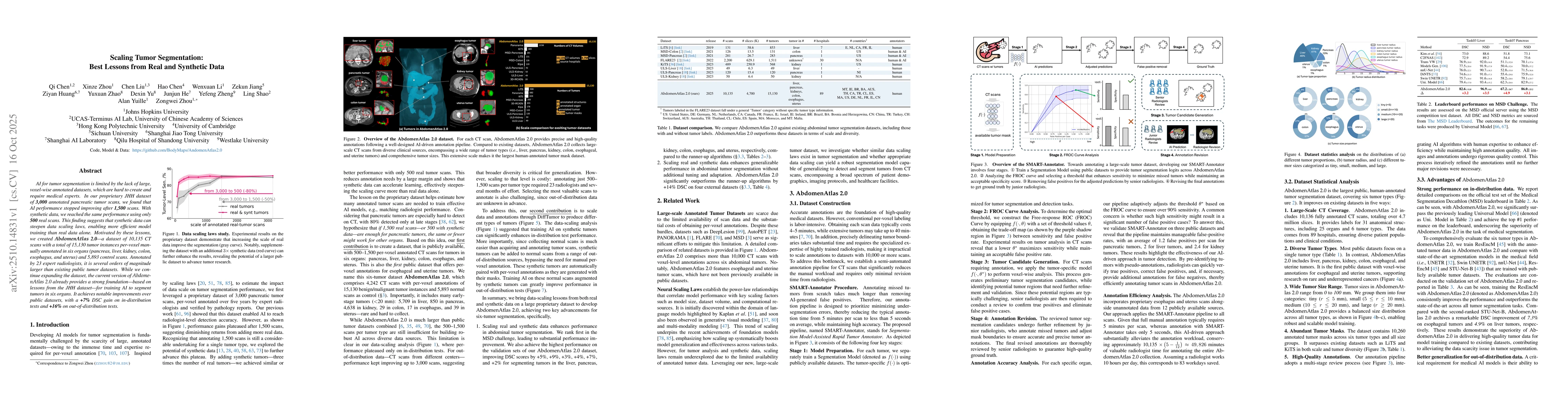 Thumbnail for Scaling Tumor Segmentation: Best Lessons from Real and Synthetic Data