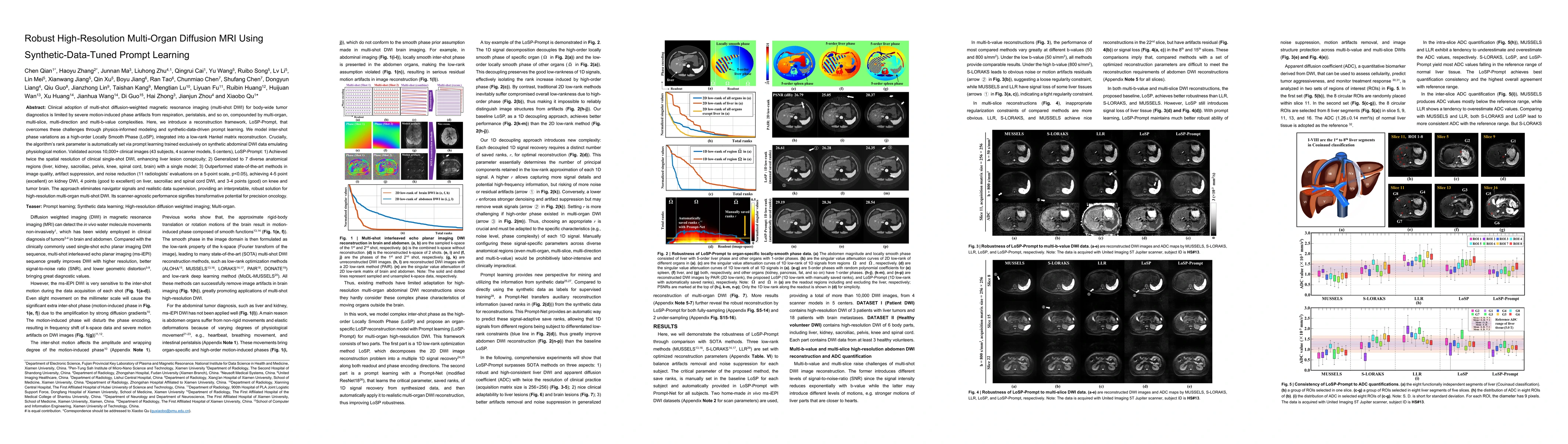 Thumbnail for Robust High-Resolution Multi-Organ Diffusion MRI Using
  Synthetic-Data-Tuned Prompt Learning