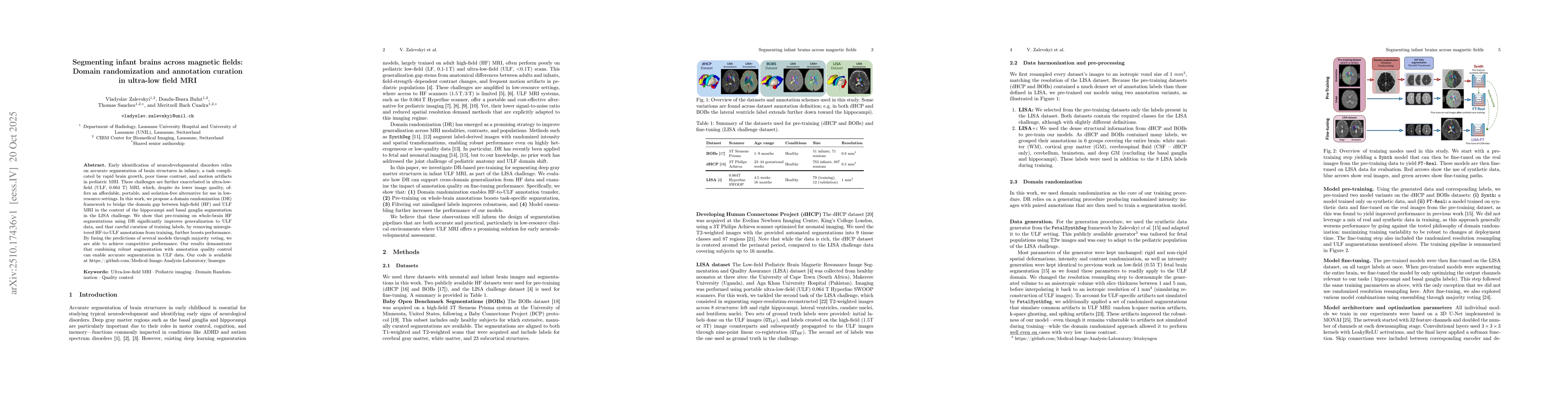 Thumbnail for Segmenting infant brains across magnetic fields: Domain randomization
  and annotation curation in ultra-low field MRI