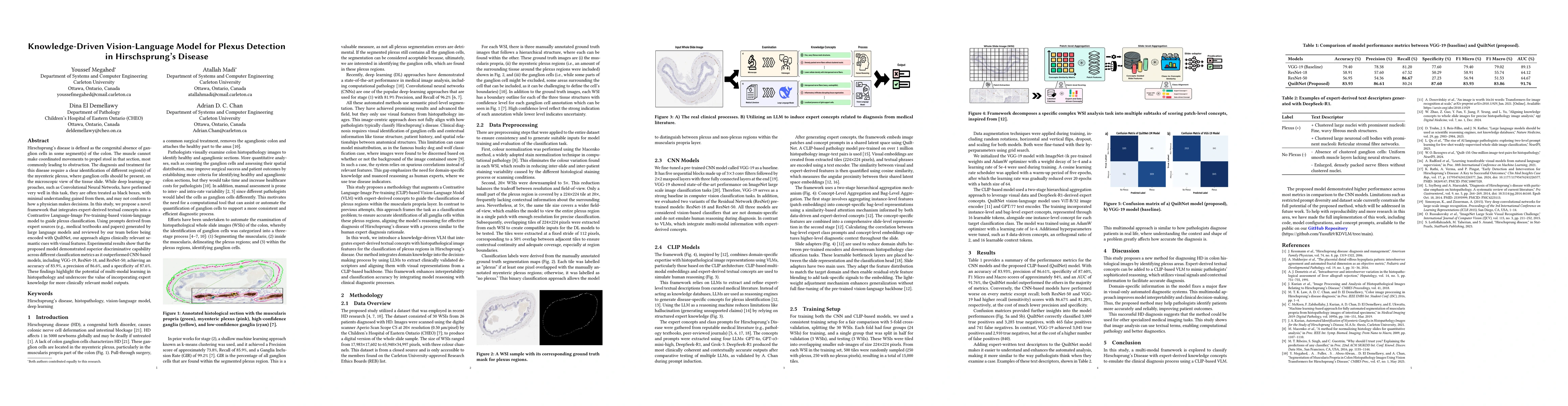 Thumbnail for Knowledge-Driven Vision-Language Model for Plexus Detection in
  Hirschsprung's Disease
