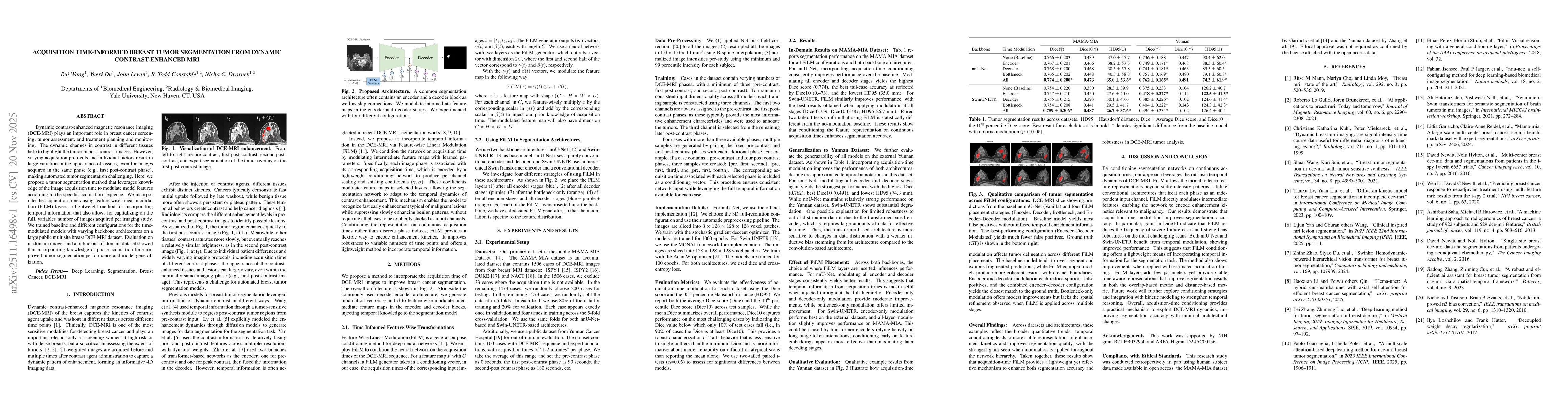 Thumbnail for Acquisition Time-Informed Breast Tumor Segmentation from Dynamic Contrast-Enhanced MRI