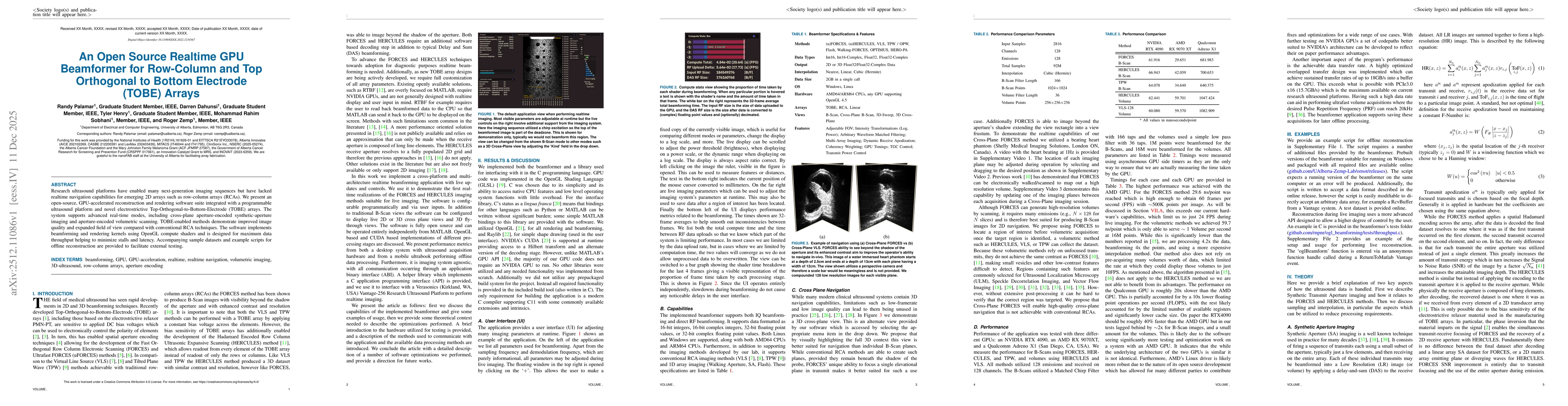 Thumbnail for An Open Source Realtime GPU Beamformer for Row-Column and Top Orthogonal to Bottom Electrode (TOBE) Arrays
