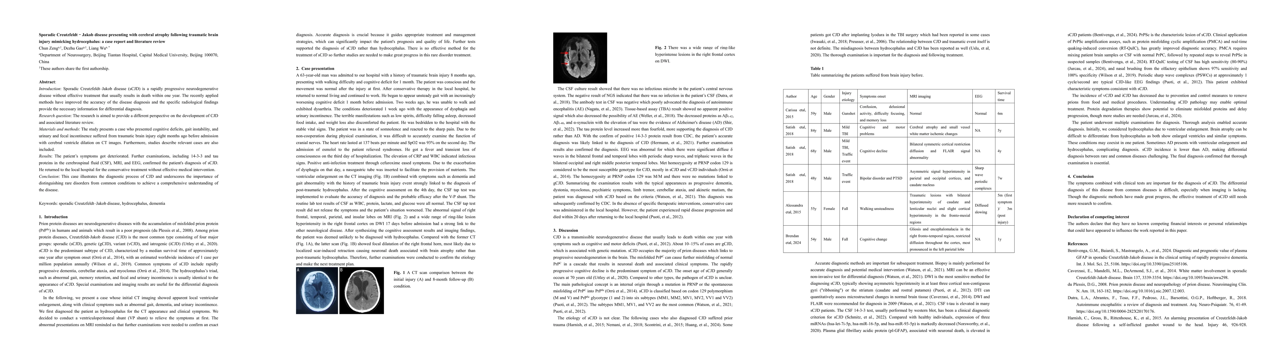 Thumbnail for Sporadic Creutzfeldt Jakob disease presenting with cerebral atrophy following traumatic brain injury mimicking hydrocephalus a case report and literature review