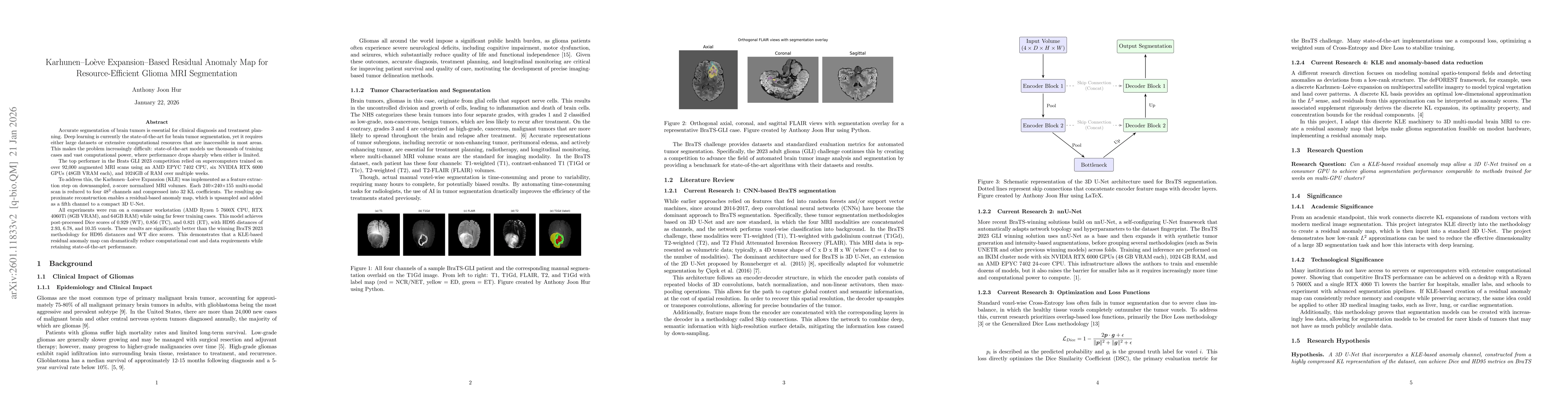 Thumbnail for Karhunen-Loève Expansion-Based Residual Anomaly Map for Resource-Efficient Glioma MRI Segmentation