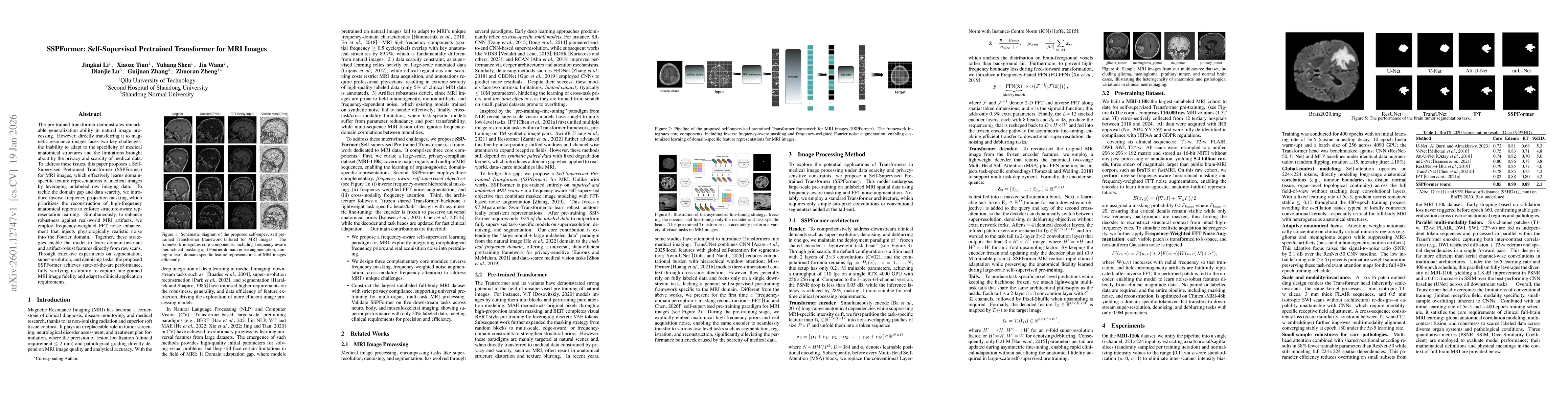 Thumbnail for SSPFormer: Self-Supervised Pretrained Transformer for MRI Images