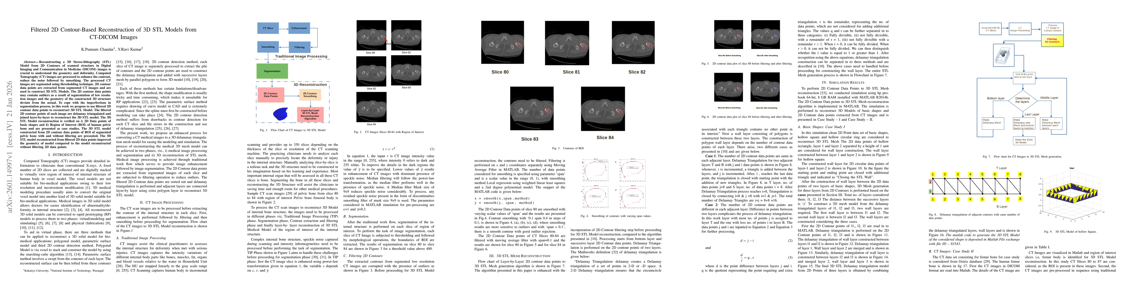 Thumbnail for Filtered 2D Contour-Based Reconstruction of 3D STL Model from CT-DICOM Images