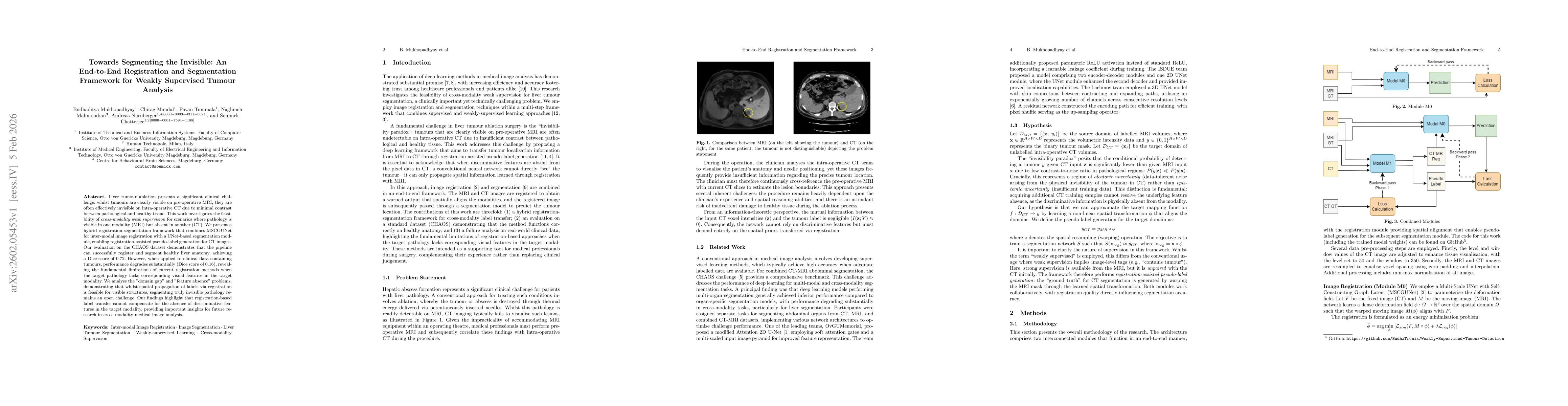 Thumbnail for Towards Segmenting the Invisible: An End-to-End Registration and Segmentation Framework for Weakly Supervised Tumour Analysis