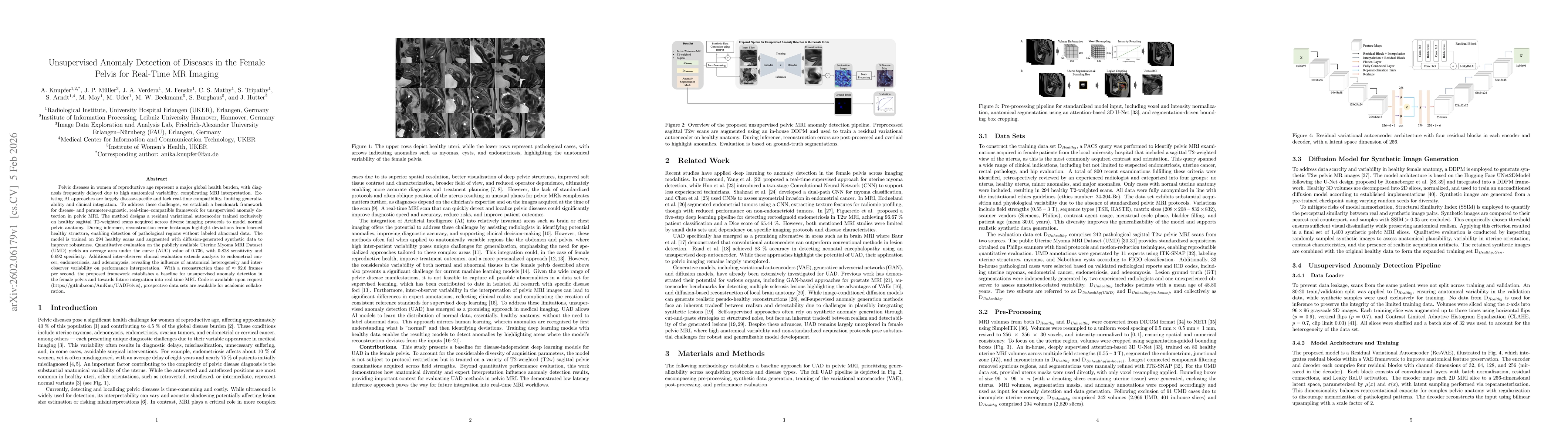 Thumbnail for Unsupervised Anomaly Detection of Diseases in the Female Pelvis for Real-Time MR Imaging