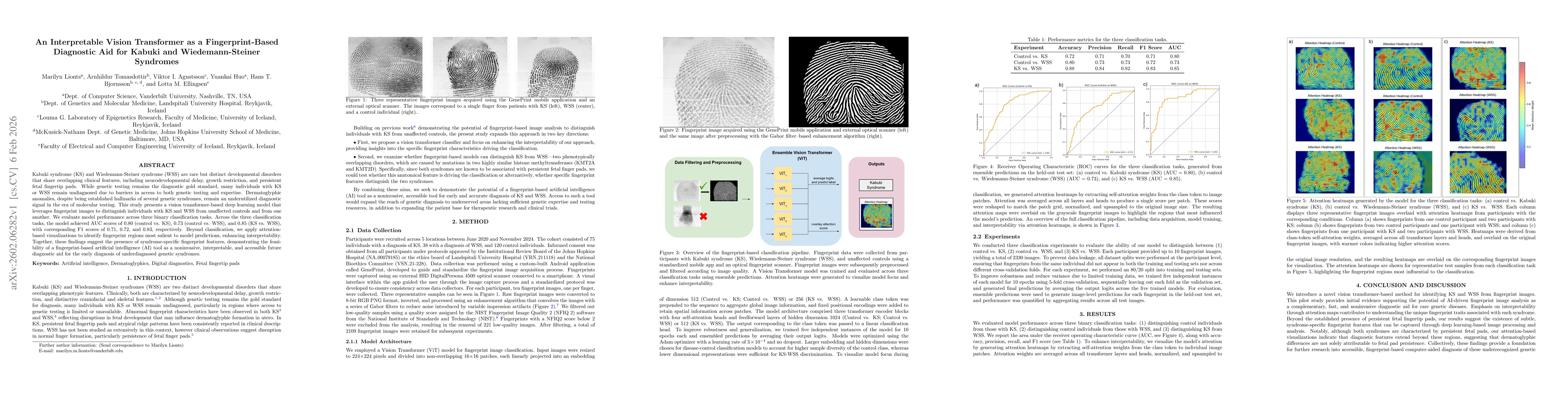 Thumbnail for An Interpretable Vision Transformer as a Fingerprint-Based Diagnostic Aid for Kabuki and Wiedemann-Steiner Syndromes