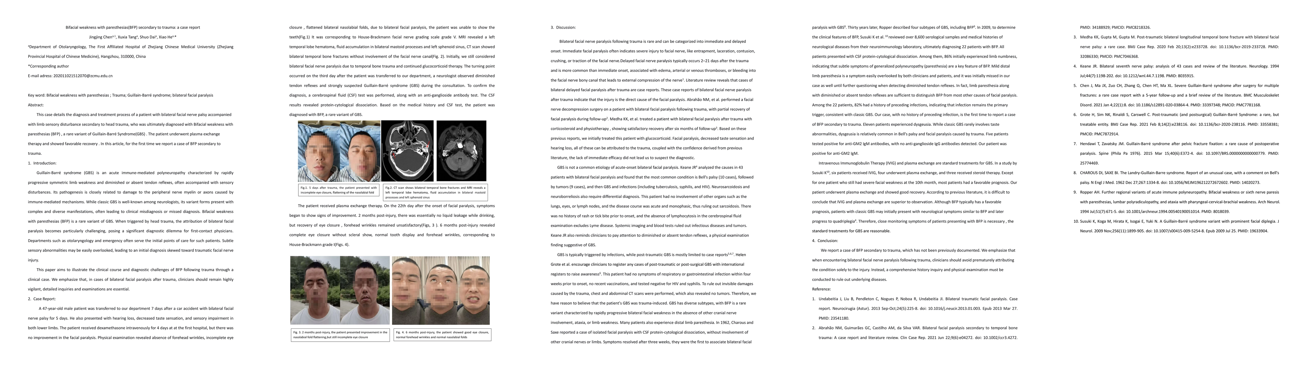 Thumbnail for Bifacial weakness with paresthesias (BFP) secondary to trauma: a case report