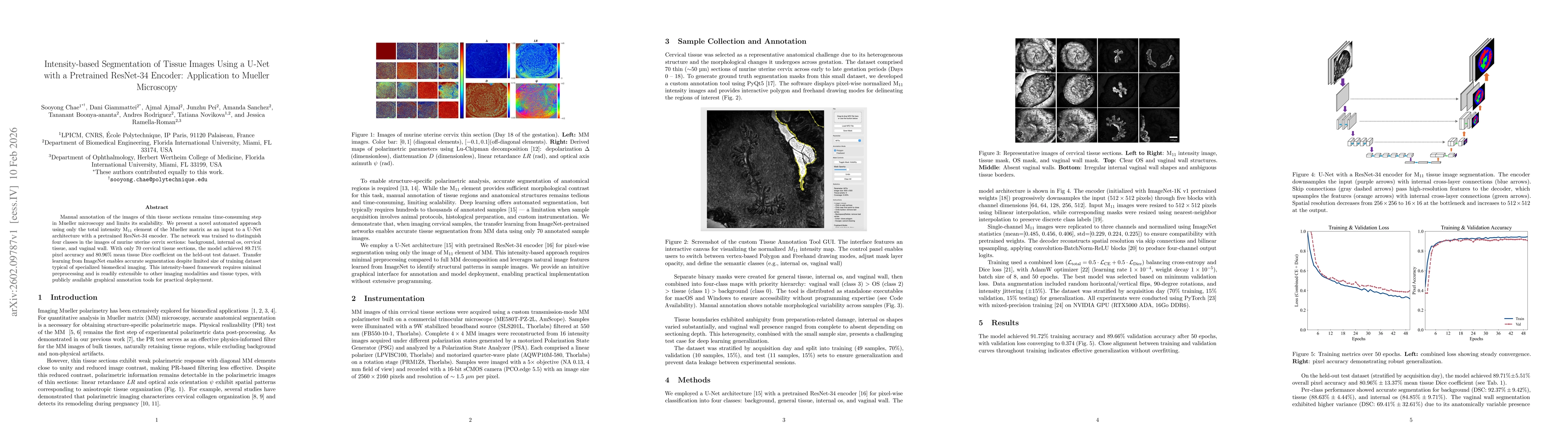 Thumbnail for Intensity-based Segmentation of Tissue Images Using a U-Net with a Pretrained ResNet-34 Encoder: Application to Mueller Microscopy