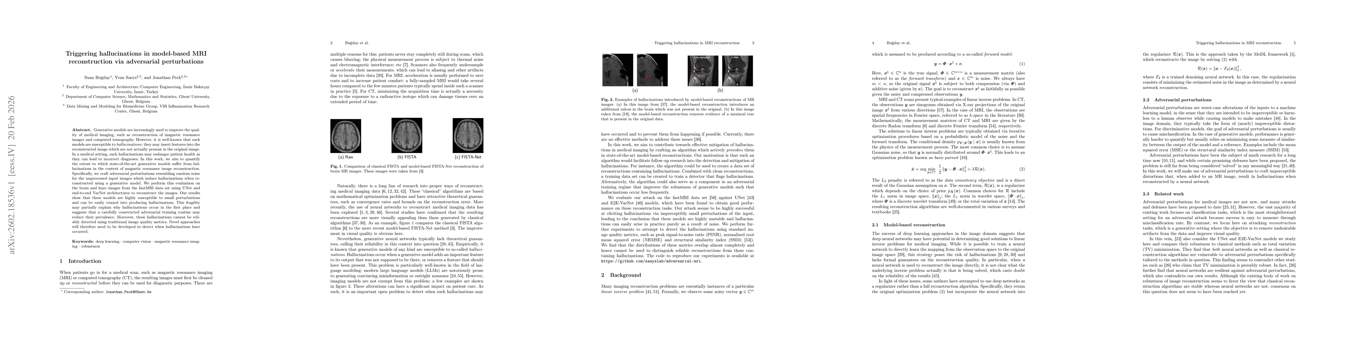 Thumbnail for Triggering hallucinations in model-based MRI reconstruction via adversarial perturbations
