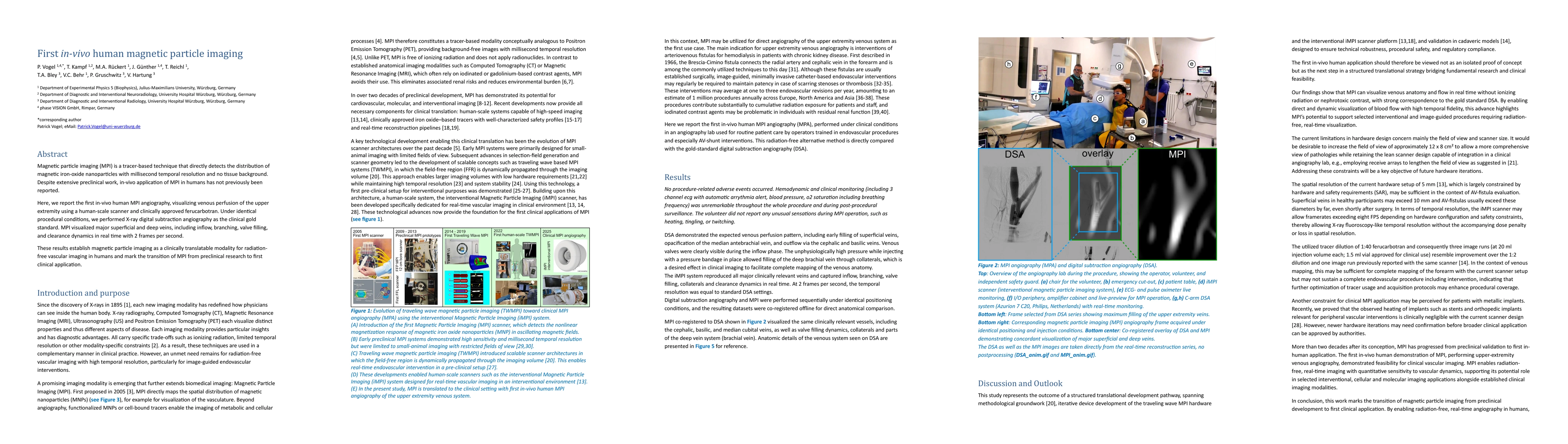 Thumbnail for First in-vivo human magnetic particle imaging