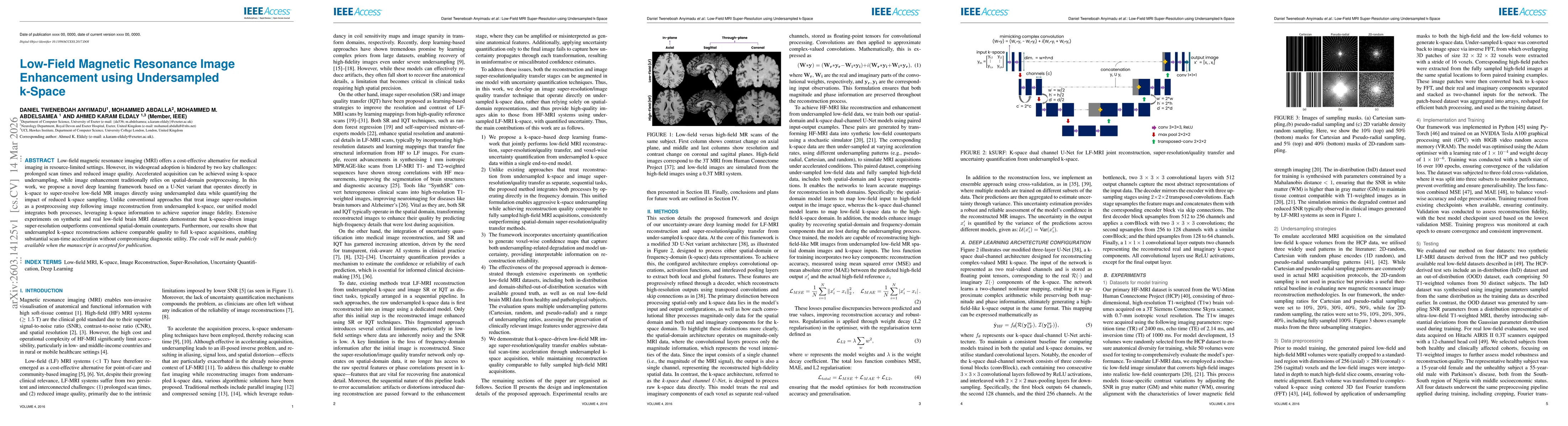 Thumbnail for Low-Field Magnetic Resonance Image Enhancement using Undersampled k-Space