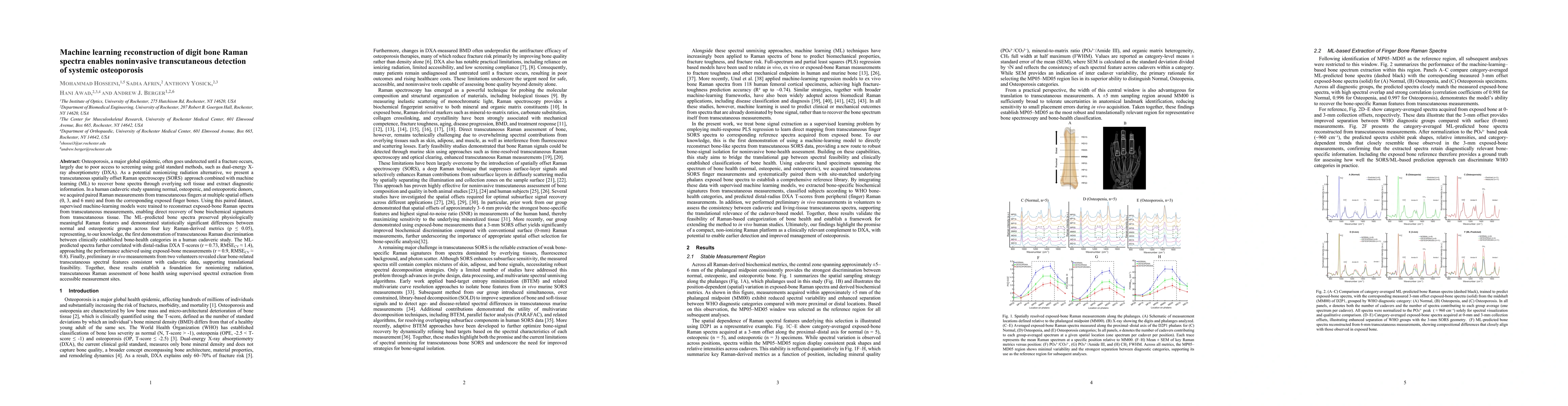 Thumbnail for Machine learning reconstruction of digit bone Raman spectra enables noninvasive transcutaneous detection of systemic osteoporosis