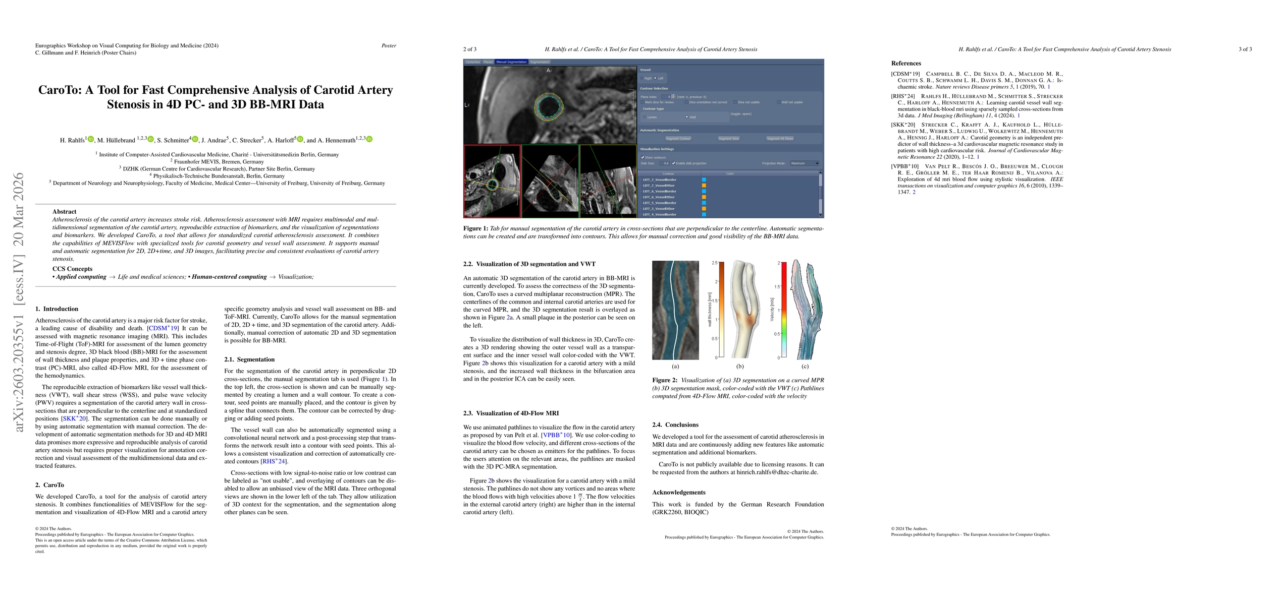 Thumbnail for CaroTo: A Tool for Fast Comprehensive Analysis of Carotid Artery Stenosis in 4D PC- and 3D BB-MRI Data