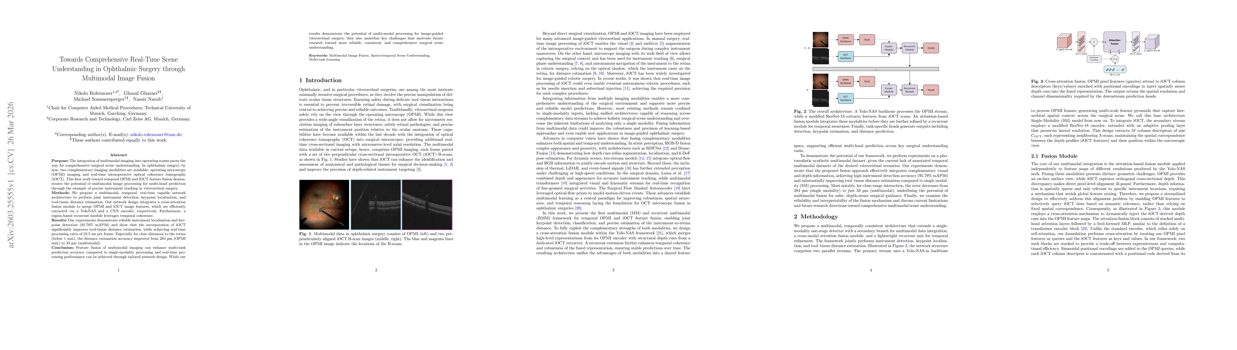Thumbnail for Towards Comprehensive Real-Time Scene Understanding in Ophthalmic Surgery through Multimodal Image Fusion