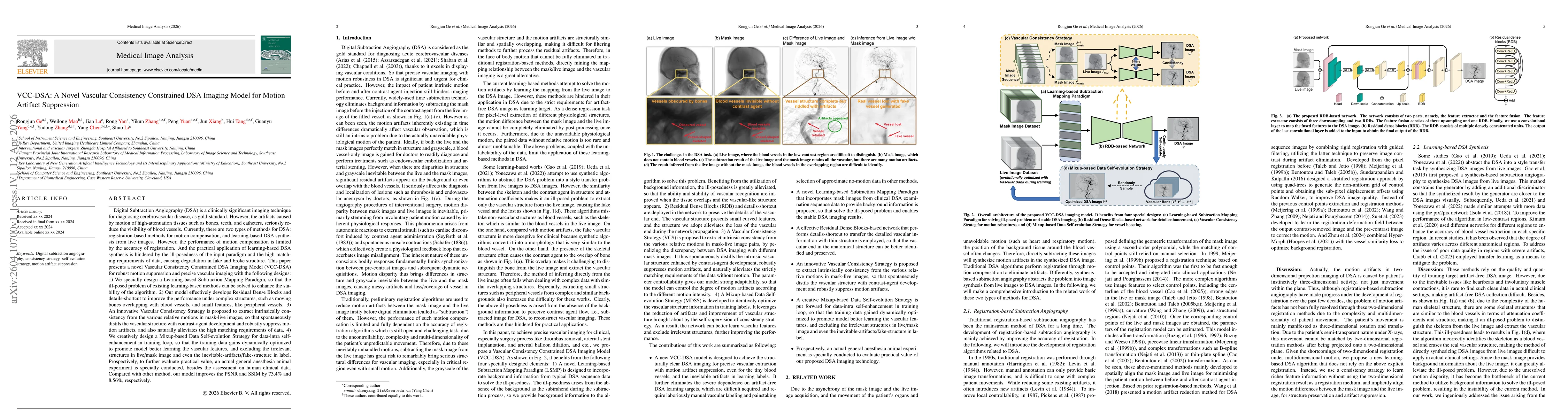 Thumbnail for VCC-DSA: A Novel Vascular Consistency Constrained DSA Imaging Model for Motion Artifact Suppression