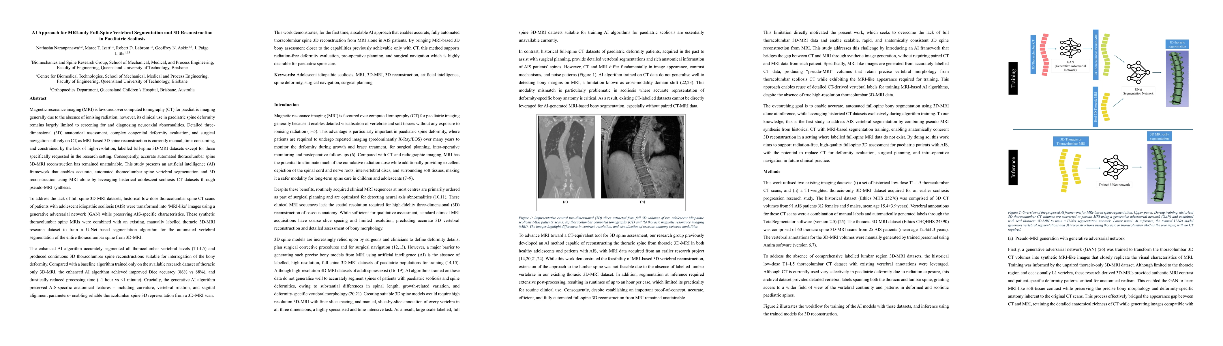 Thumbnail for AI Approach for MRI-only Full-Spine Vertebral Segmentation and 3D Reconstruction in Paediatric Scoliosis