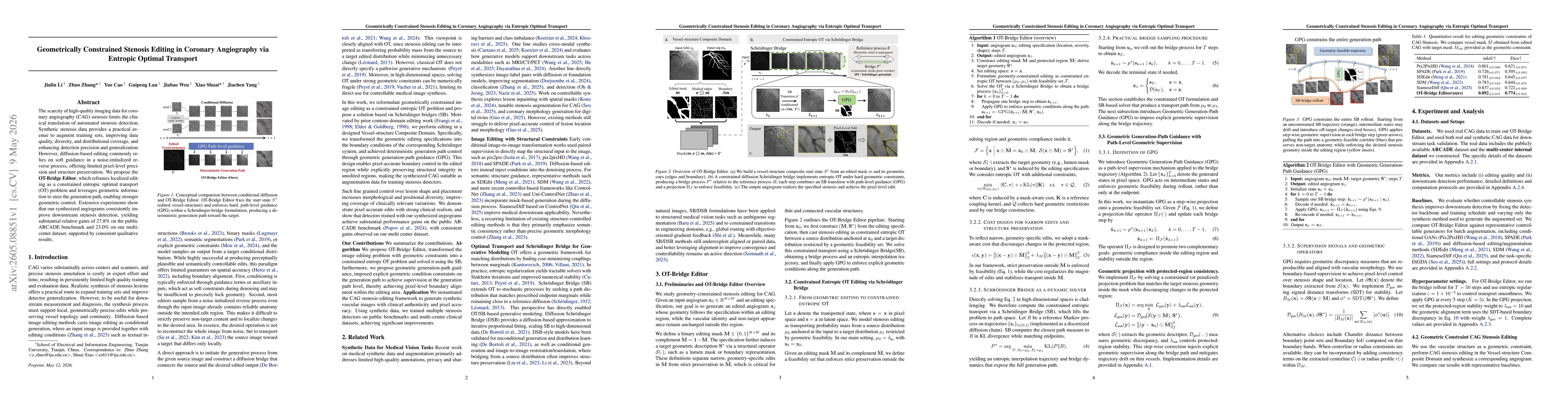 Thumbnail for Geometrically Constrained Stenosis Editing in Coronary Angiography via Entropic Optimal Transport