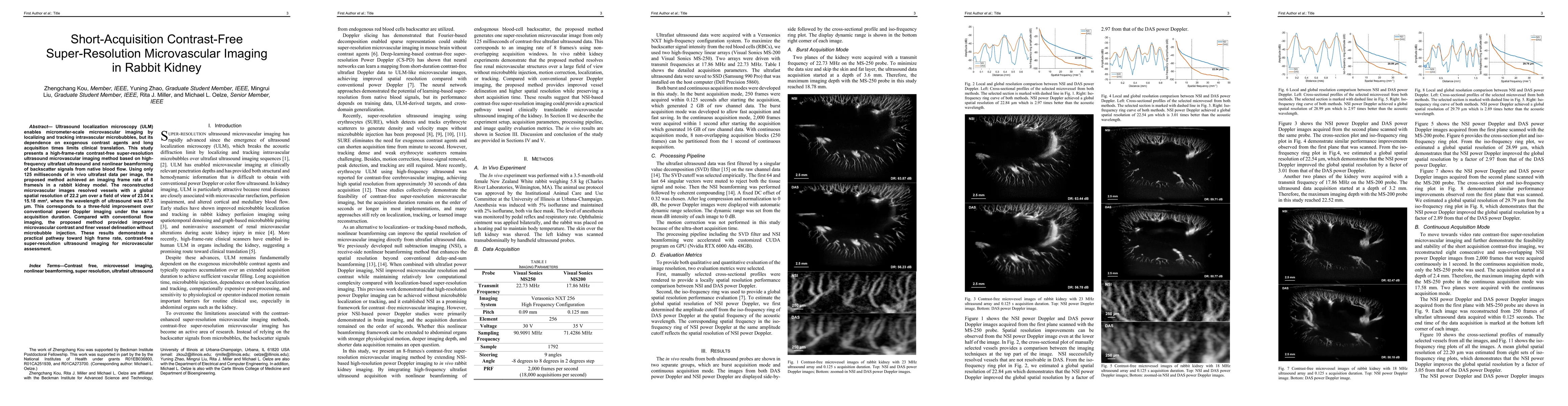Thumbnail for Short-Acquisition Contrast-Free Super-Resolution Microvascular Imaging in Rabbit Kidney