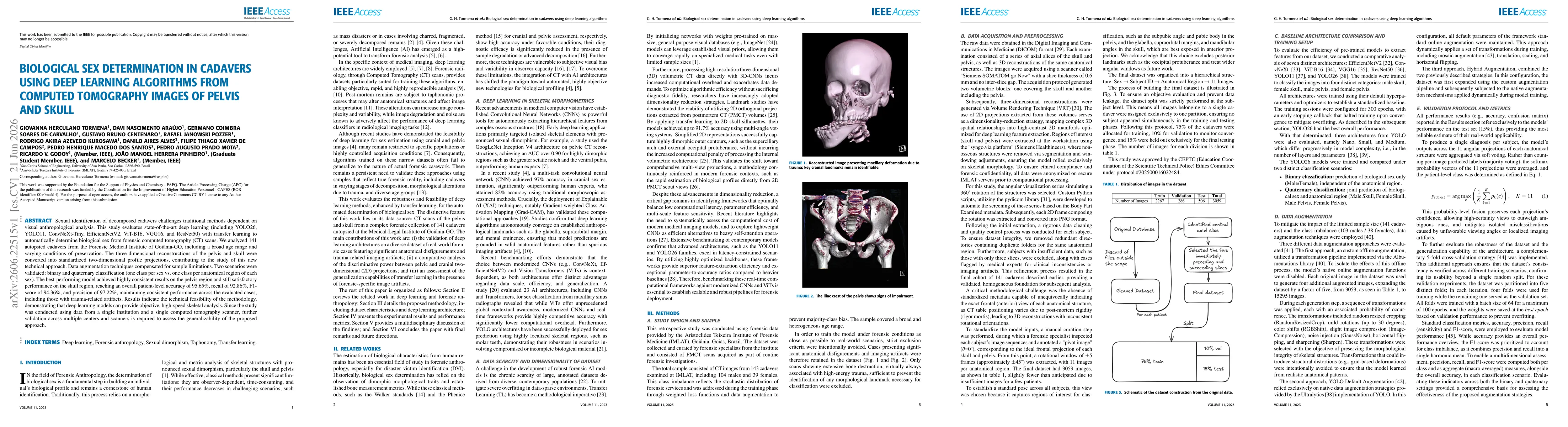 Thumbnail for Biological Sex Determination in Cadavers Using Deep Learning Algorithms from Computed Tomography Images of Pelvis and Skull