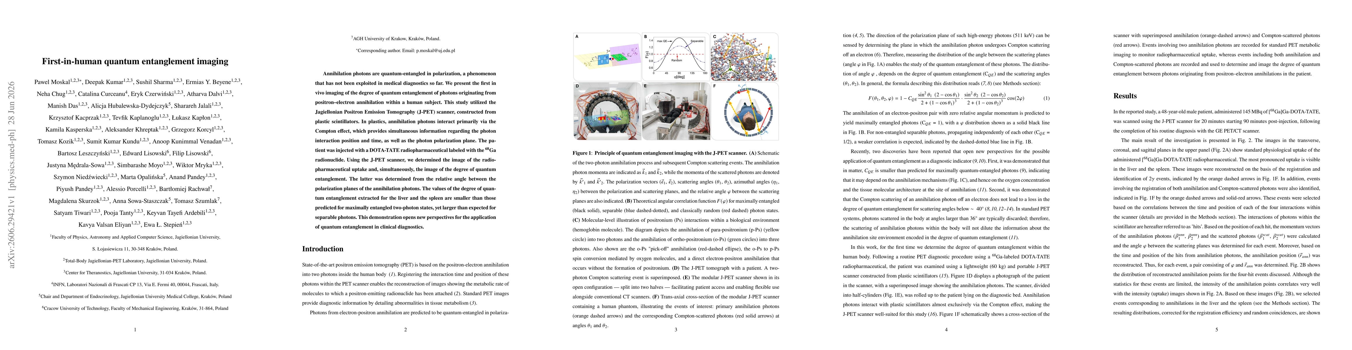 Thumbnail for First-in-human quantum entanglement imaging
