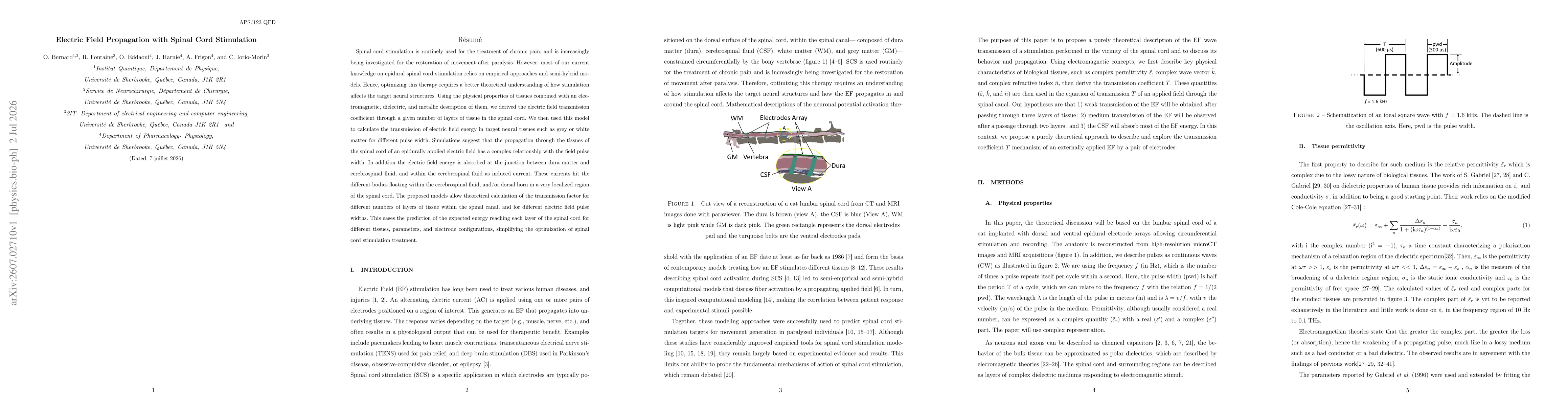 Thumbnail for Electric Field Propagation with Spinal Cord Stimulation