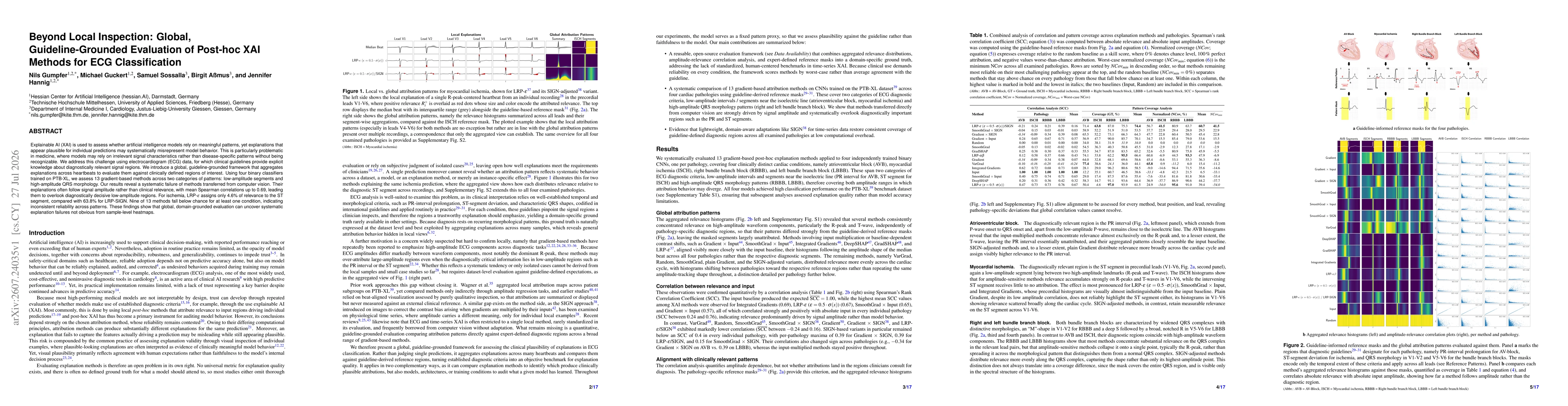Thumbnail for Beyond Local Inspection: Global, Guideline-Grounded Evaluation of Post-hoc XAI Methods for ECG Classification