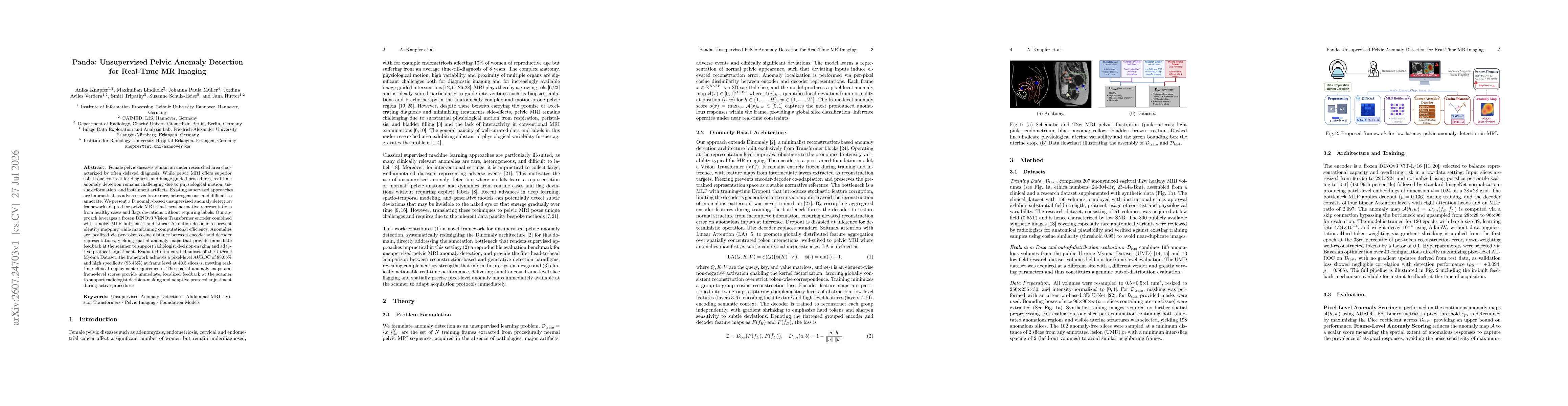 Thumbnail for Panda: Unsupervised Pelvic Anomaly Detection for Real-Time MR Imaging