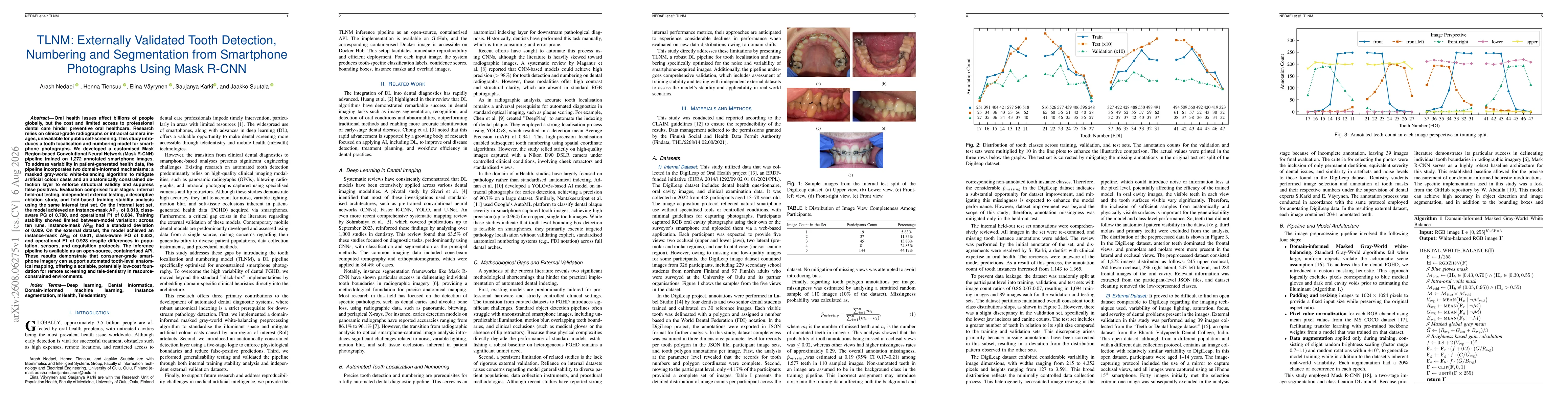 Thumbnail for TLNM: Externally Validated Tooth Detection, Numbering and Segmentation from Smartphone Photographs Using Mask R-CNN