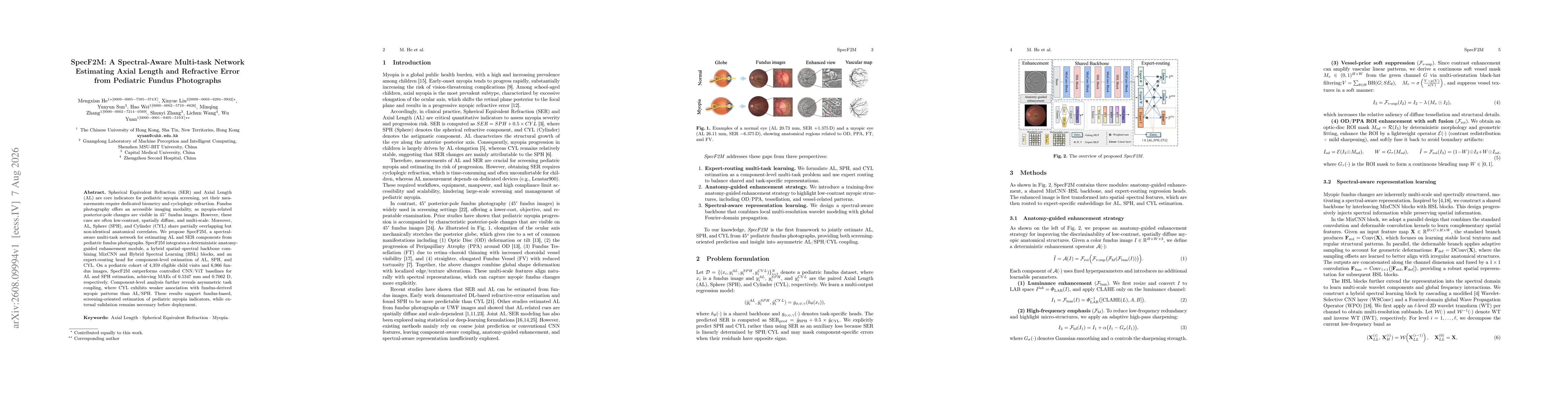 Thumbnail for SpecF2M: A Spectral-Aware Multi-task Network Estimating Axial Length and Refractive Error from Pediatric Fundus Photographs