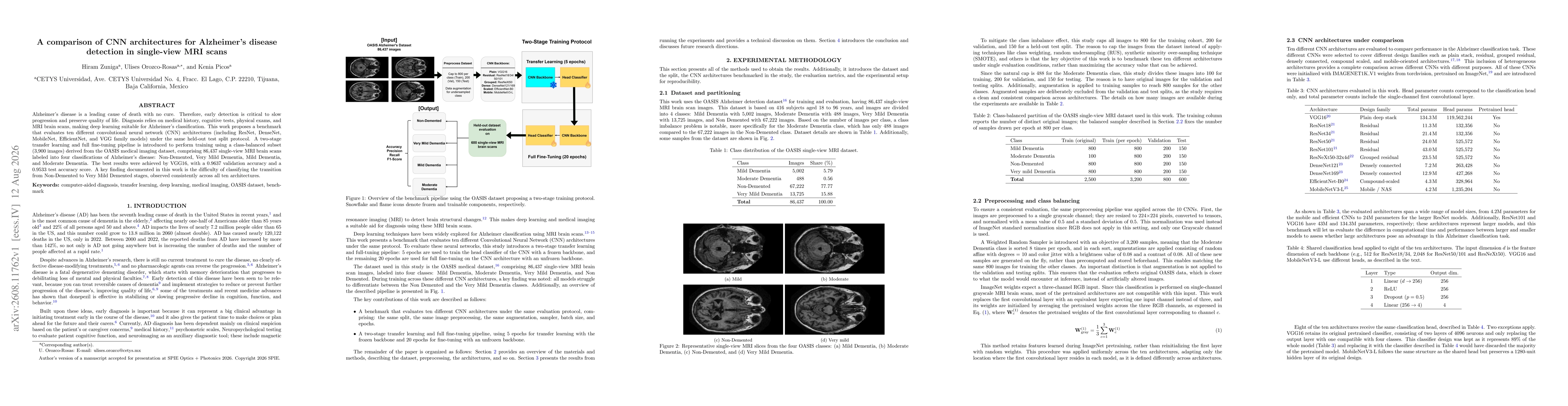 Thumbnail for A comparison of CNN architectures for Alzheimer's disease detection in single-view MRI scans