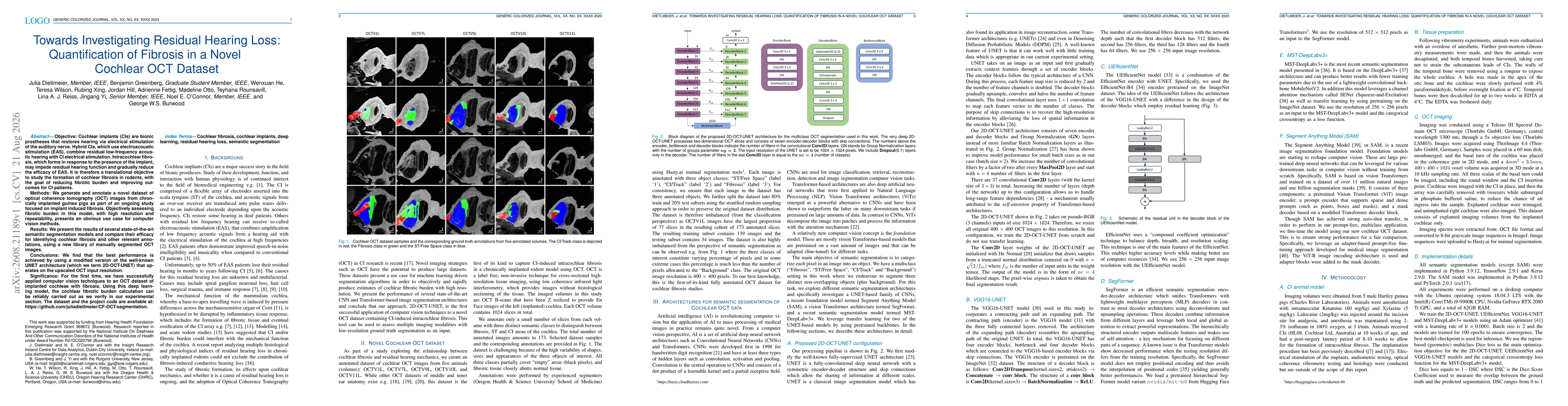 Thumbnail for Towards Investigating Residual Hearing Loss: Quantification of Fibrosis in a Novel Cochlear OCT Dataset