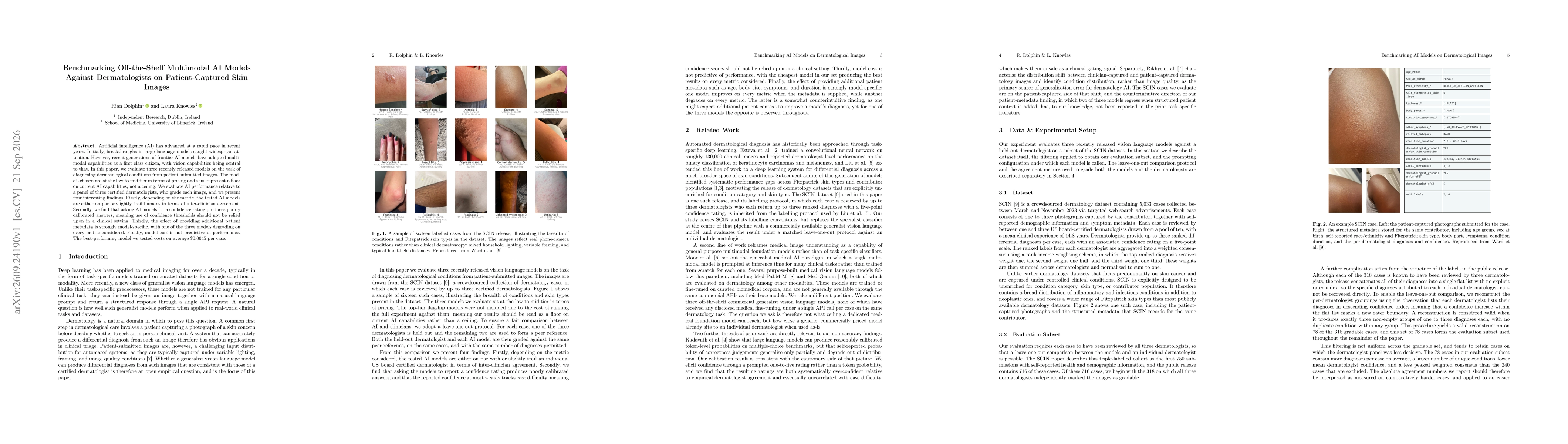 Thumbnail for Benchmarking Off-the-Shelf Multimodal AI Models Against Dermatologists on Patient-Captured Skin Images