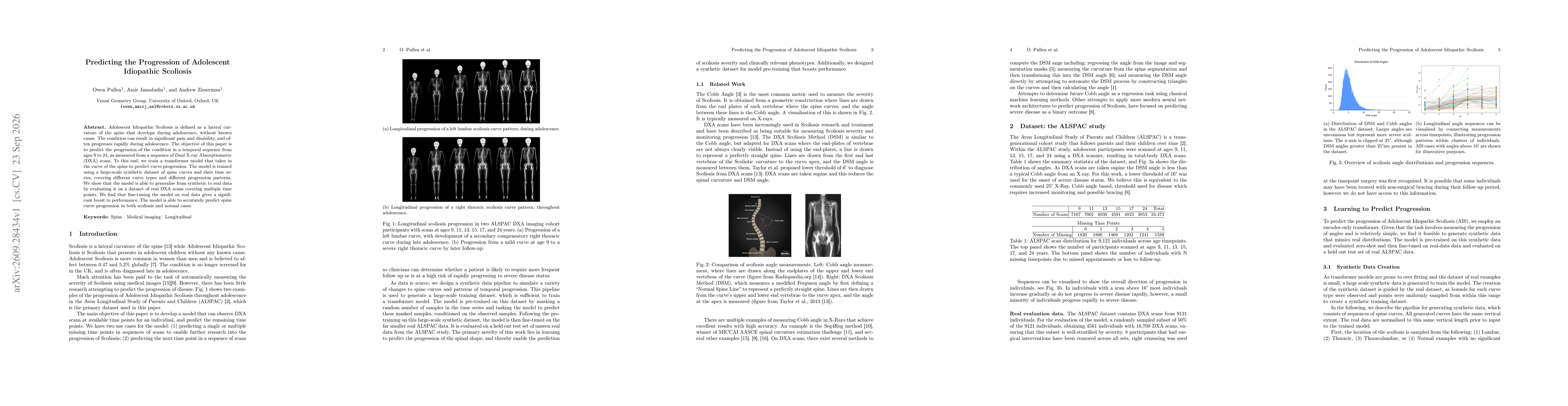 Thumbnail for Predicting the Progression of Adolescent Idiopathic Scoliosis
