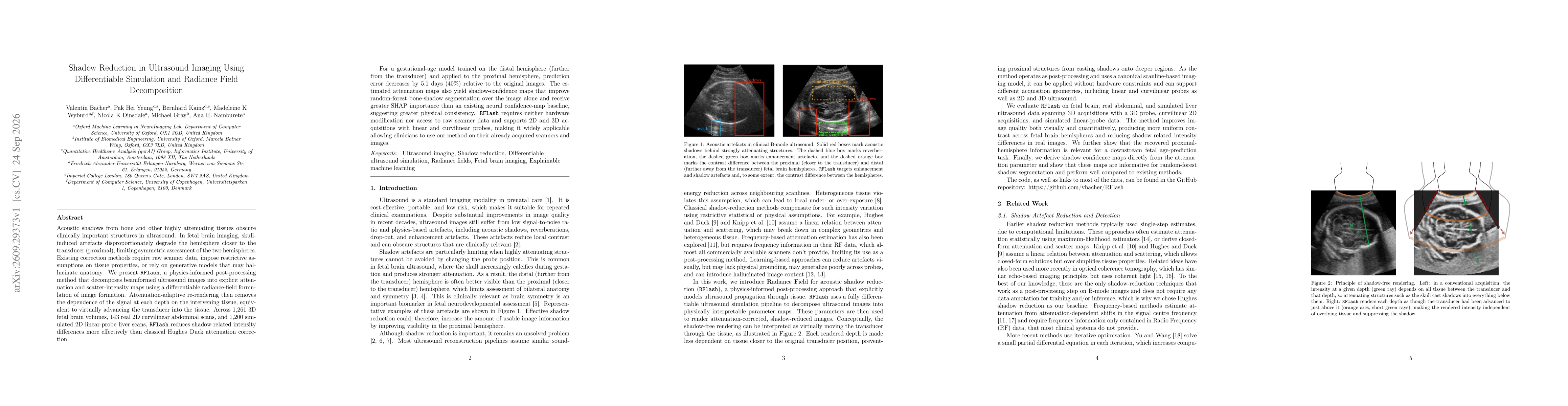 Thumbnail for Shadow Reduction in Ultrasound Imaging Using Differentiable Simulation and Radiance Field Decomposition