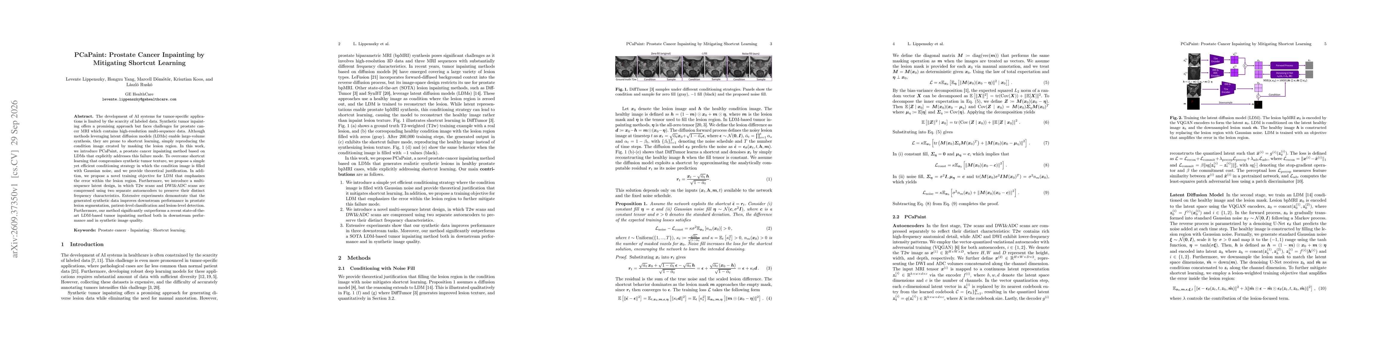Thumbnail for PCaPaint: Prostate Cancer Inpainting by Mitigating Shortcut Learning