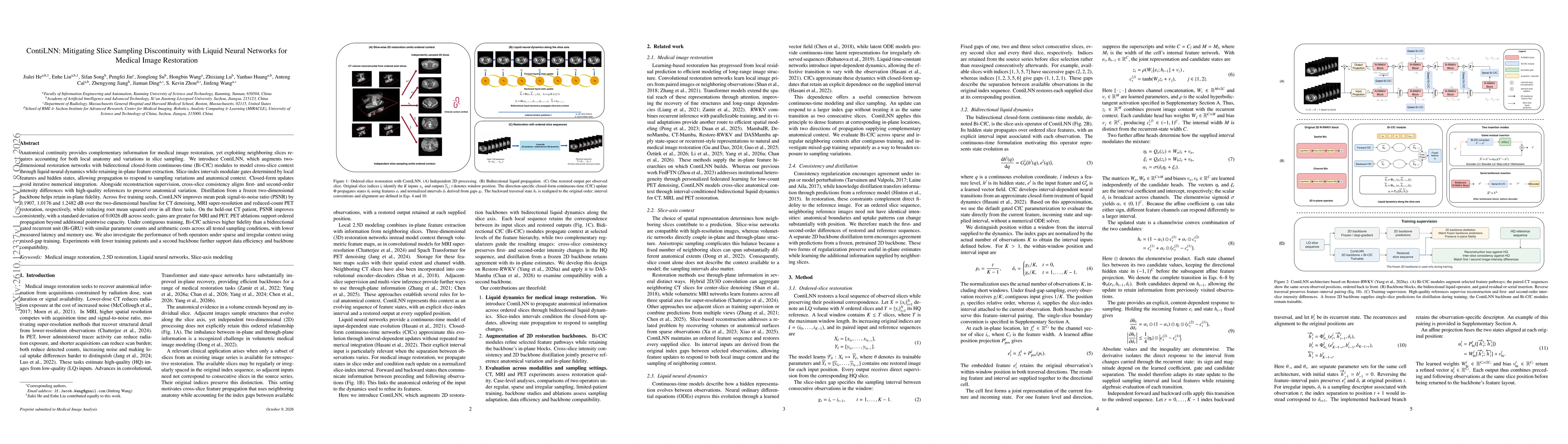 Thumbnail for ContiLNN: Mitigating Slice Sampling Discontinuity with Liquid Neural Networks for Medical Image Restoration