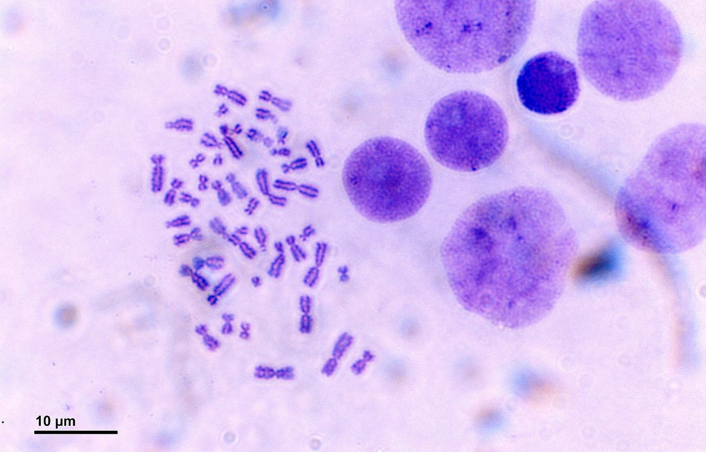 Human karyotype (248 27) Human karyotype.jpg