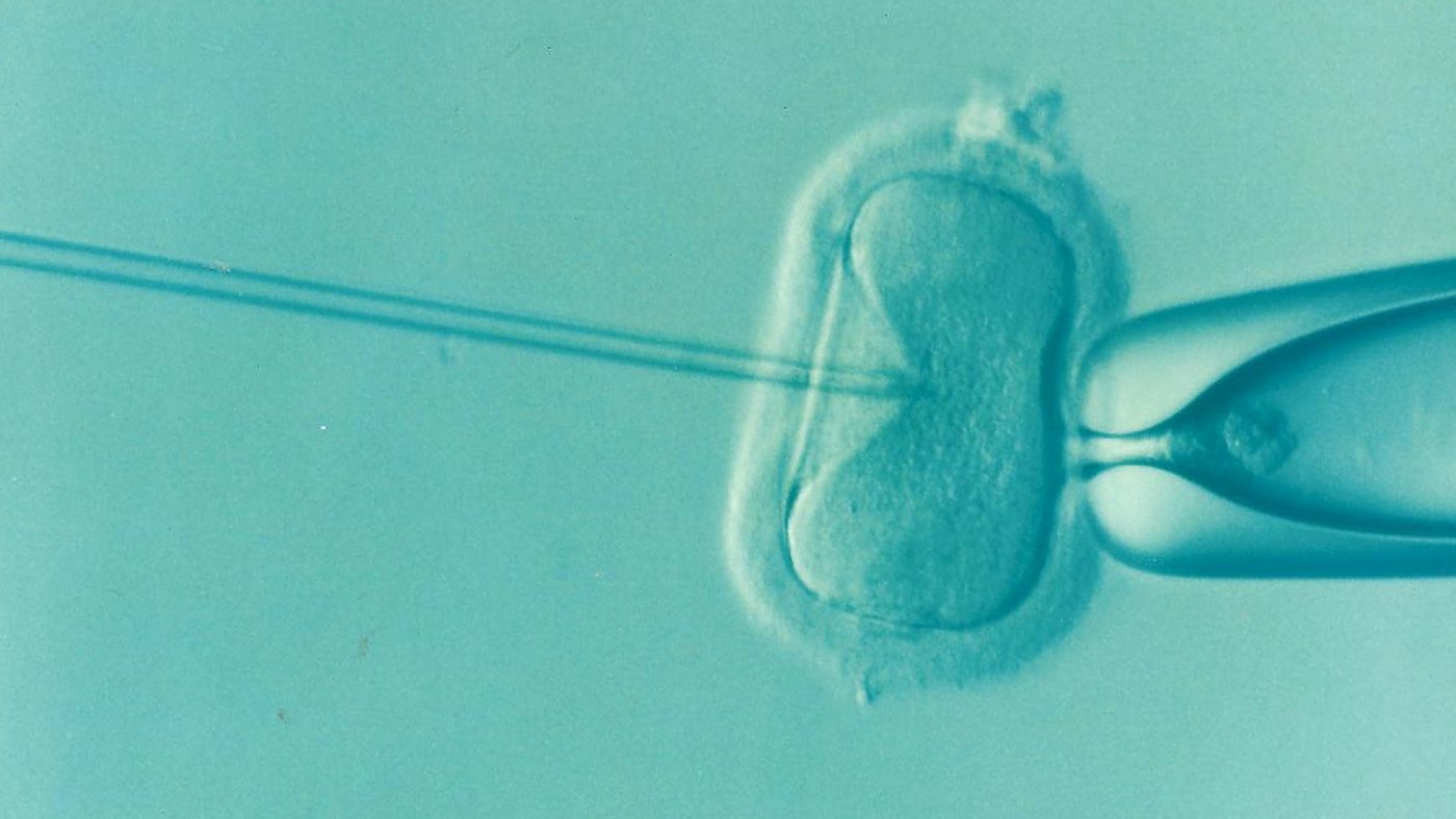 ICSI intracytoplasmic sperm injection.png