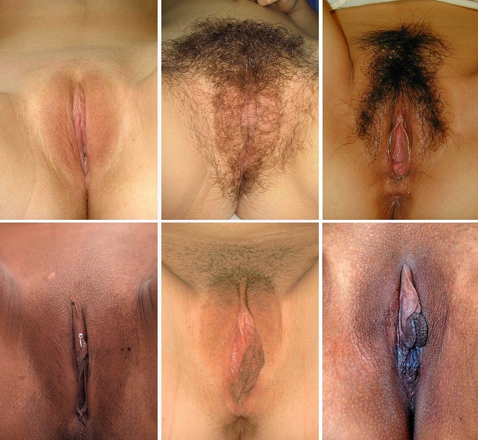 Vulva