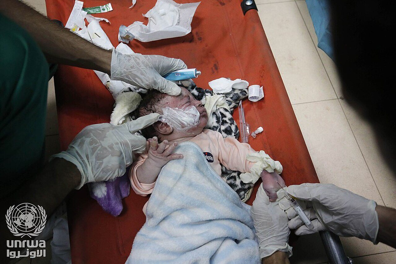 View of Palestinians injured by an Israeli airstrike in Deir el-Balah, Gaza Strip