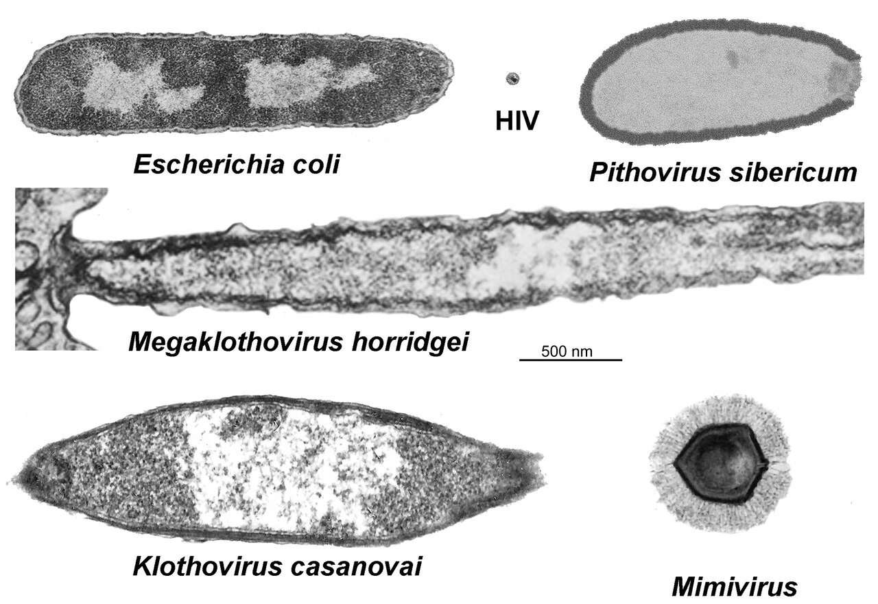 Molecular-level observation of the self-assembly of a virus-like particle